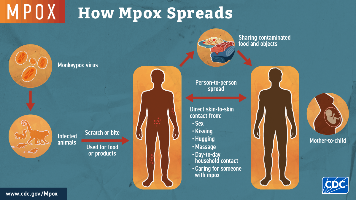 how mpox spreads graphic