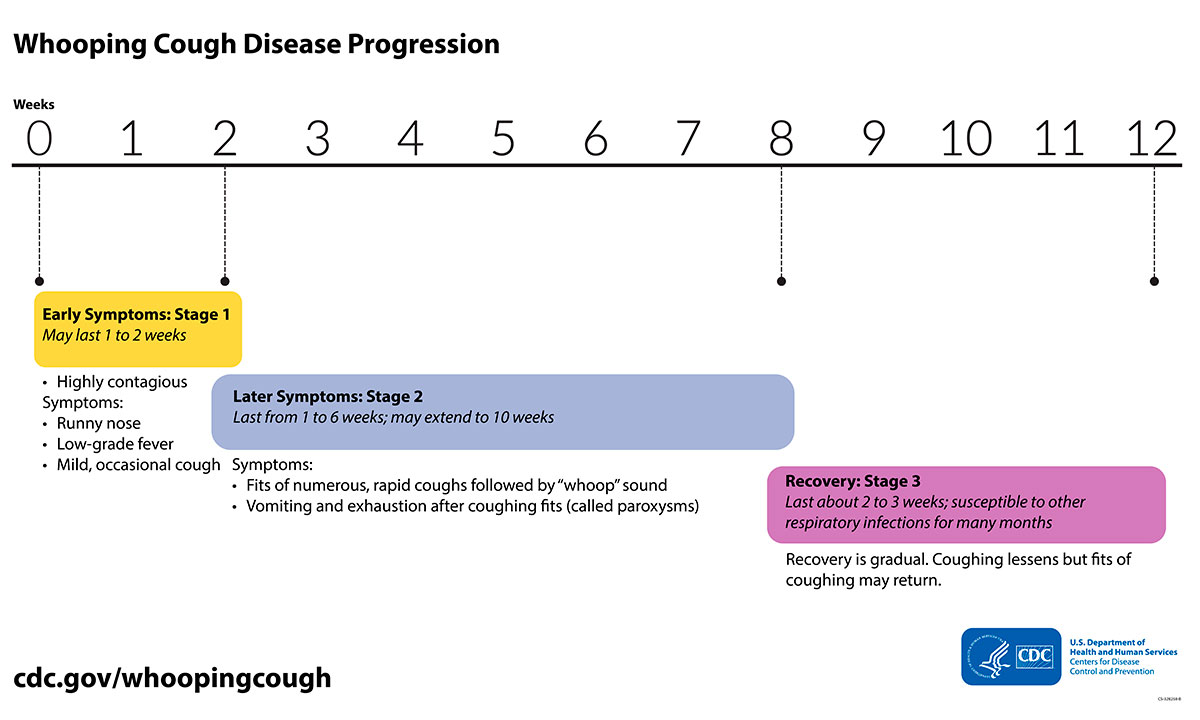 whooping cough disease progression chart
